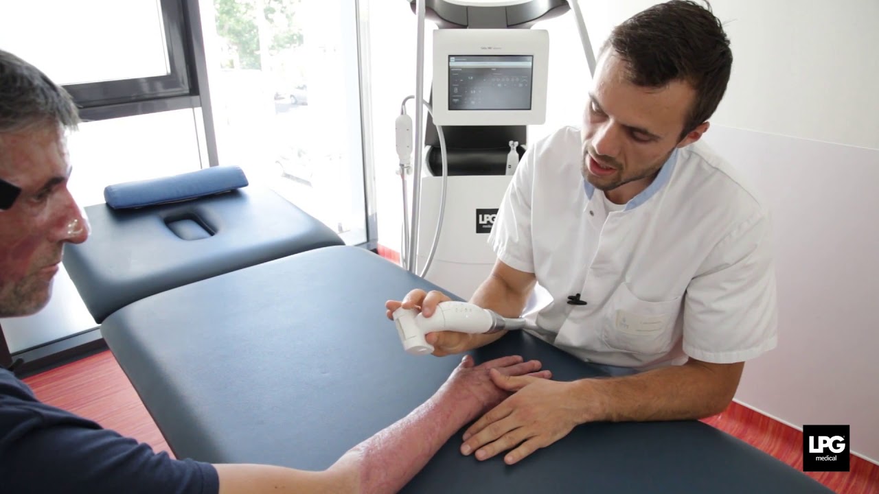Prise en charge des séquelles de brûlures (bras) avec Cellu M6 Alliance® - Clinique du DR STER