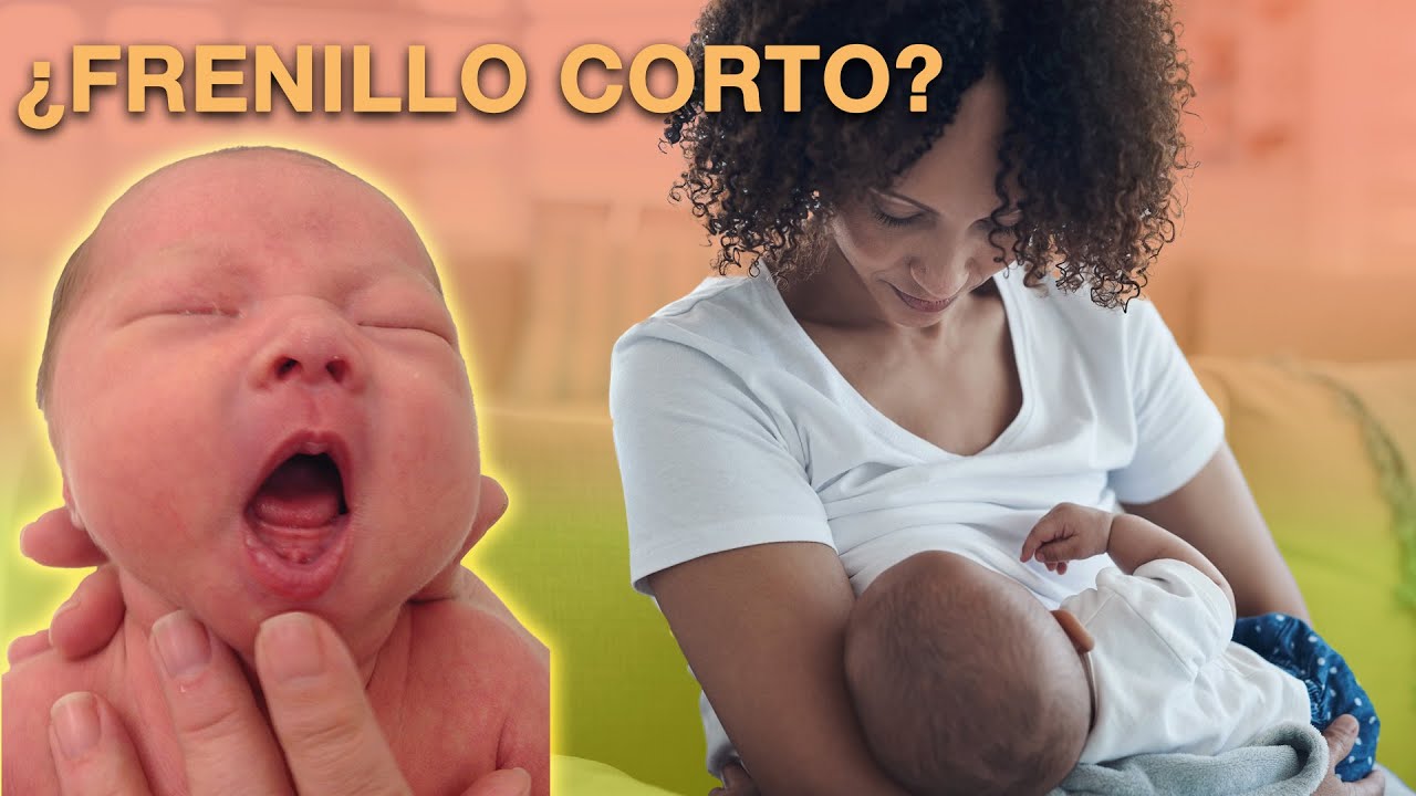 Frenillo corto: &iquest;cu&aacute;ndo es necesaria la frenotom&iacute;a?| AAP
