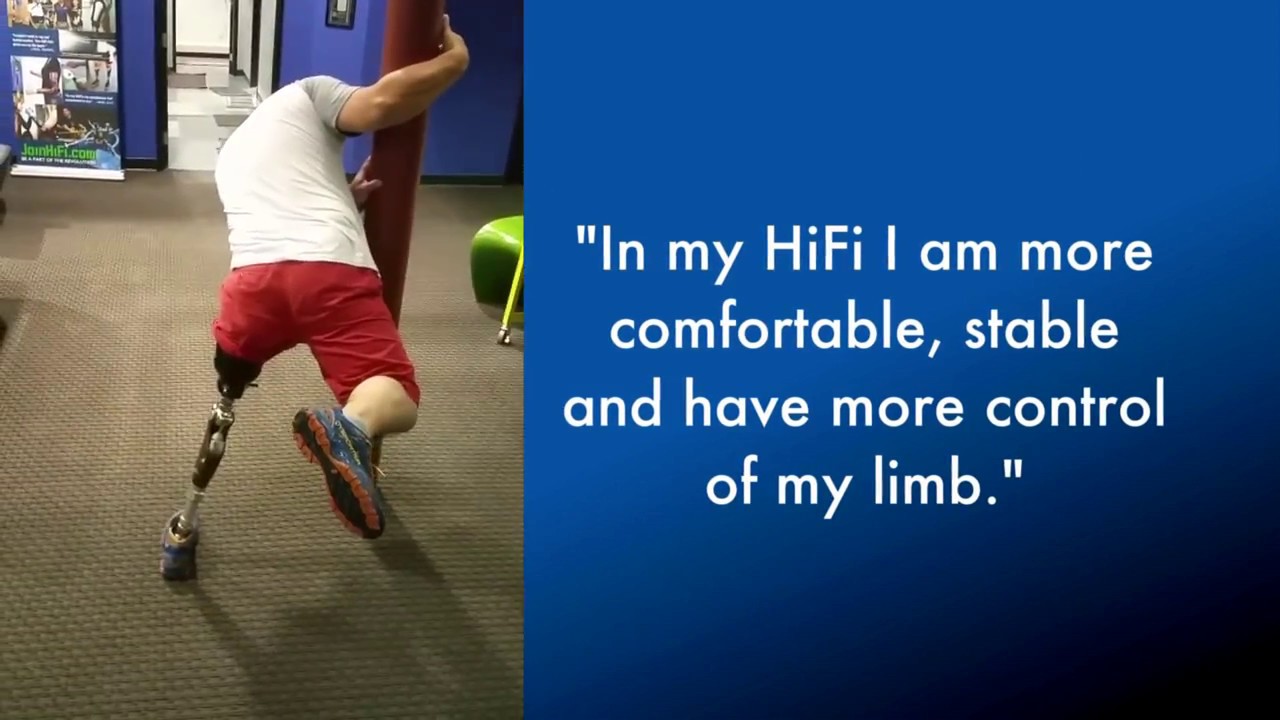 HiFi Above Knee Prosthetic Socket - Kick Your Bucket