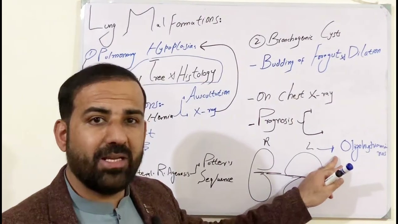 Lung Malformations