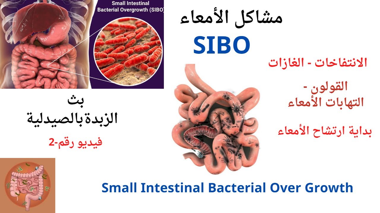 SIBO-2-مشاكل الامعاء/الانتفاخ والغازات / تحسس من الطعام /القولون/ ارتشاح الامعاء / الزبدة بالصيدلية