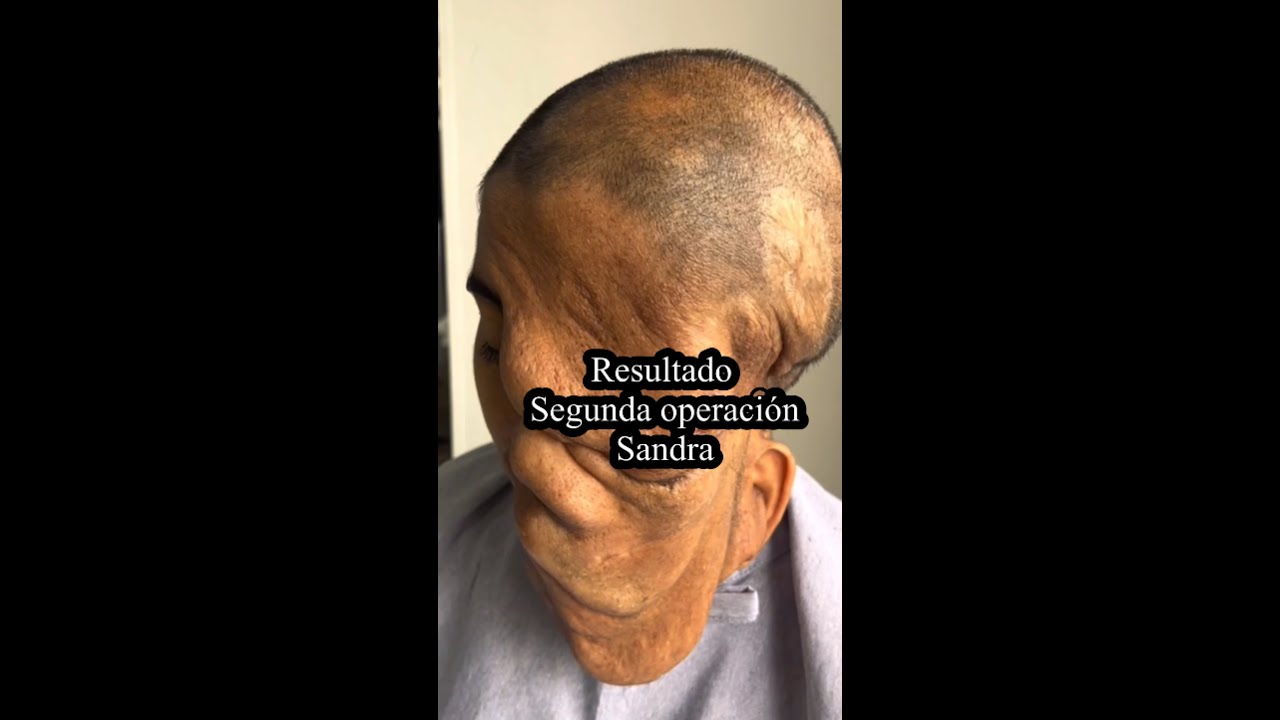 Cambio EXTREMO al rostro de Sandra