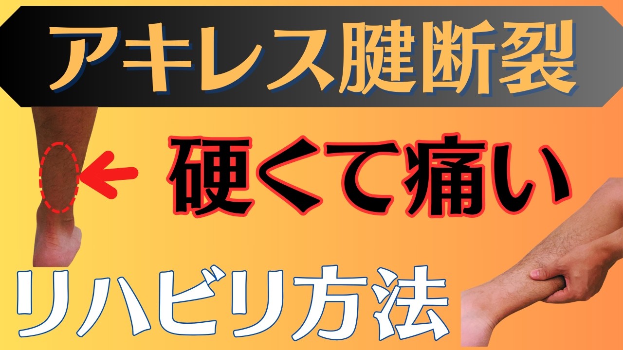 【多い痛み】アキレス腱断裂　アキレス腱の上の部分の痛み