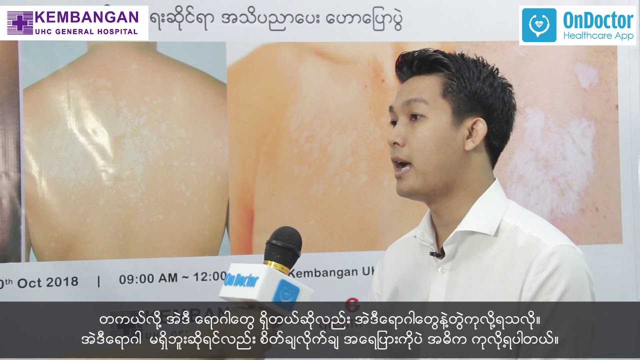 Vitiligo Treatment by Dr Wai Yan Phyo
