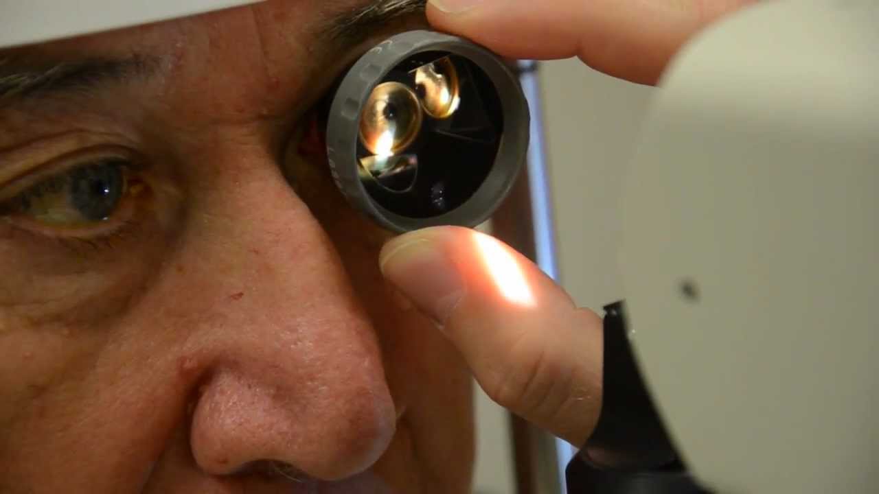Glaucoma: testimonios de pacientes