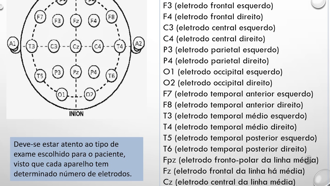 Eletroencefalograma