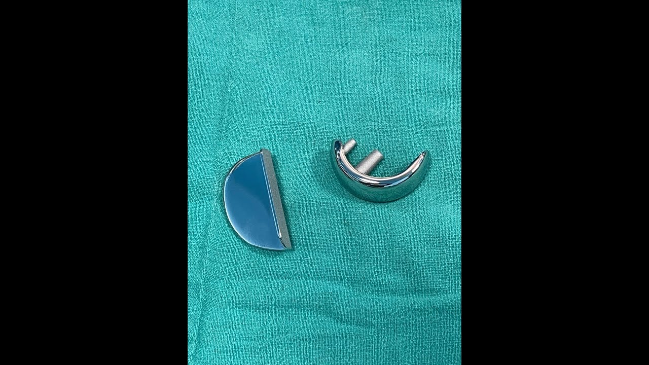 Partial knee Replacement (UKR)- Live with Dr Pankaj Walecha 01.03.2026