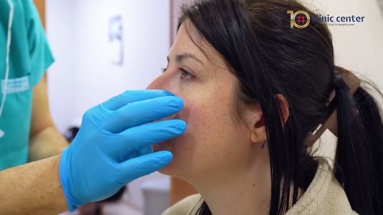 Lara's Rhinoplasty Journey | Clinic Center