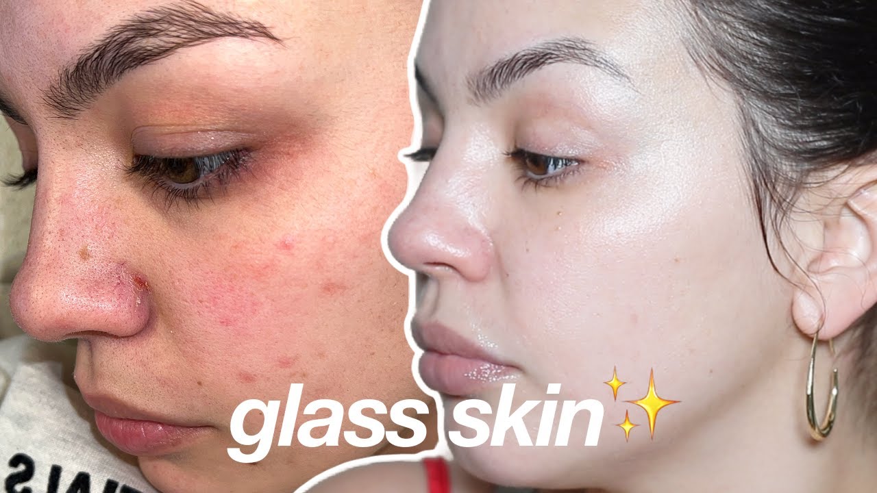*TRETINOIN* SKINCARE ROUTINE | Achieving Glass Skin in My 30s