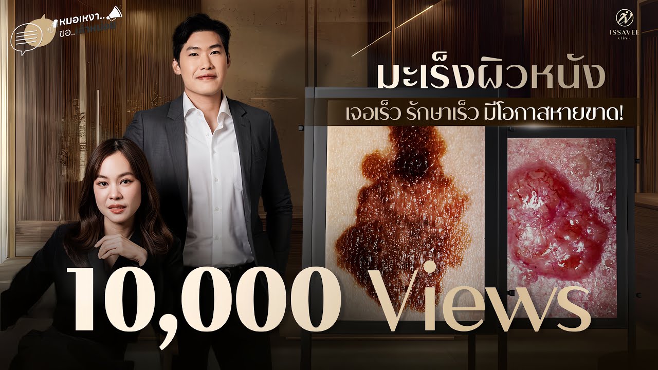 มะเร็งผิวหนัง เจอเร็ว รักษาได้ มีโอกาสหายขาด! หมอเหงาขอเล่าหน่อย EP 2