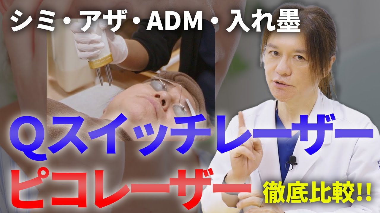 【シミ治療/アザ治療/ADM治療/入れ墨除去】Qスイッチレーザーとピコレーザーの違いを徹底解説！どちらが良いのかはっきり言います！