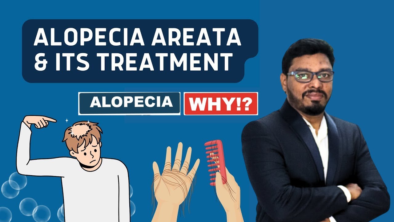 How to Cure Hair Fungal Infection Naturally | Alopecia Areata | Hair Tips | Hair growth | Dr Herbal