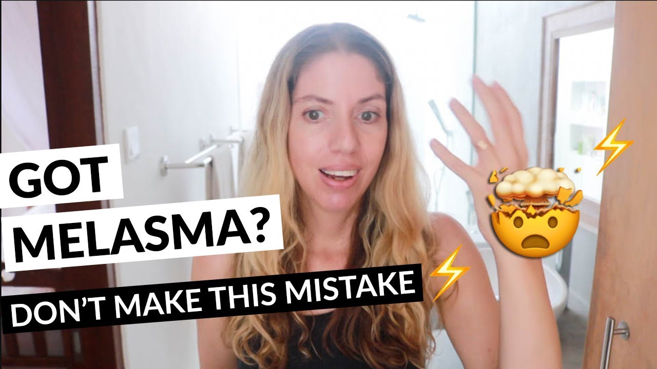 Can Exercising Make Melasma Worse? (What You Need To Know)