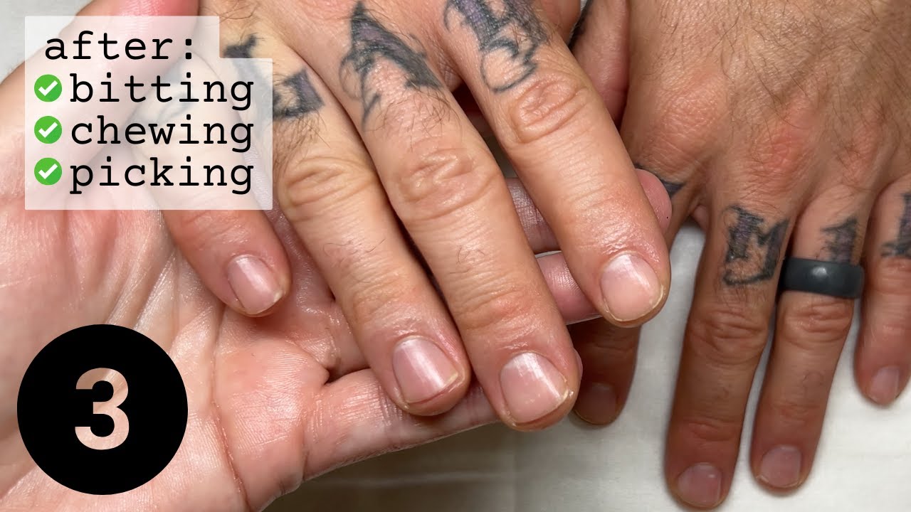 Check out this progress! Restart your nails.... after falling off the wagon [PART 3]