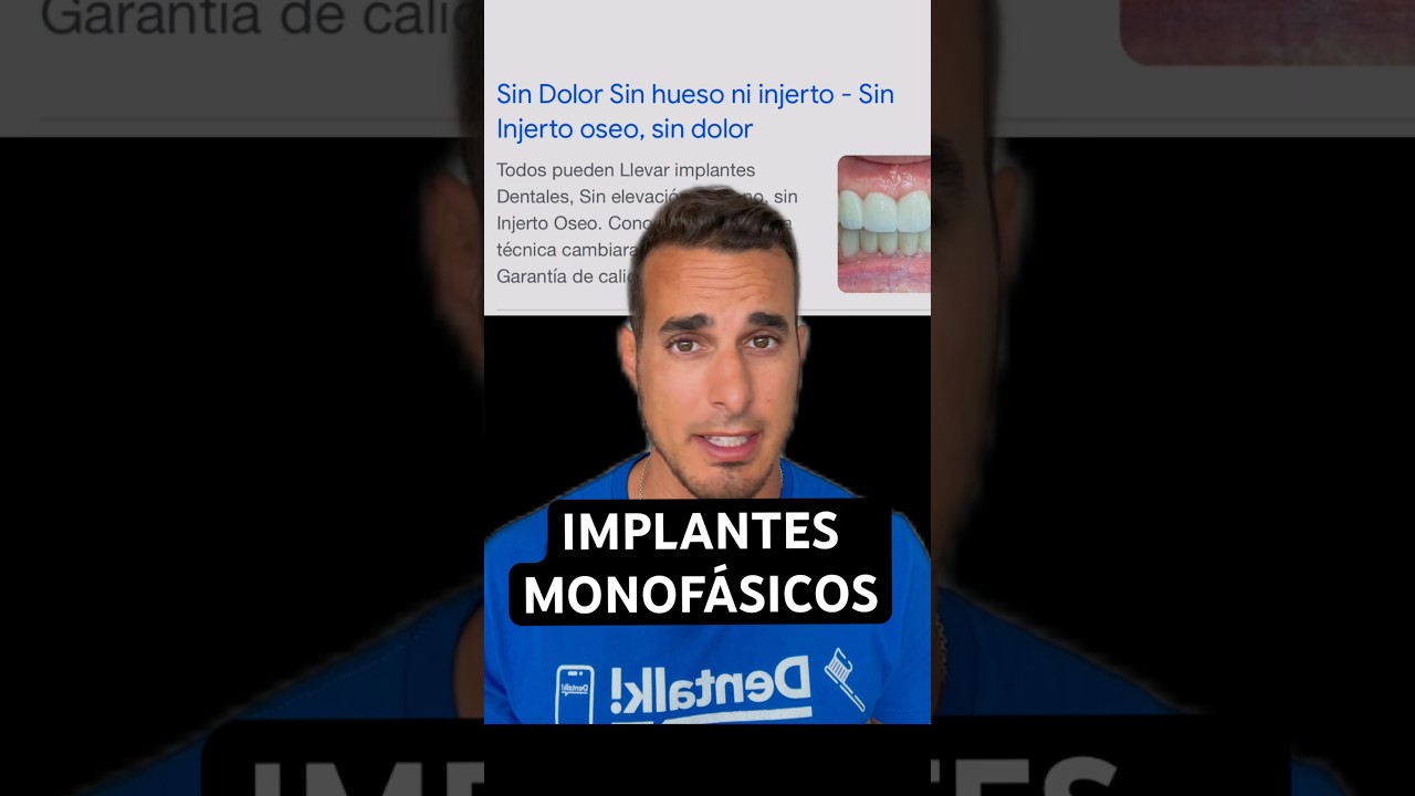 La verdad sobre los IMPLANTES DENTALES MONOFÁSICOS o MONOBLOCK - ¿Sin hueso y sin cirugía?