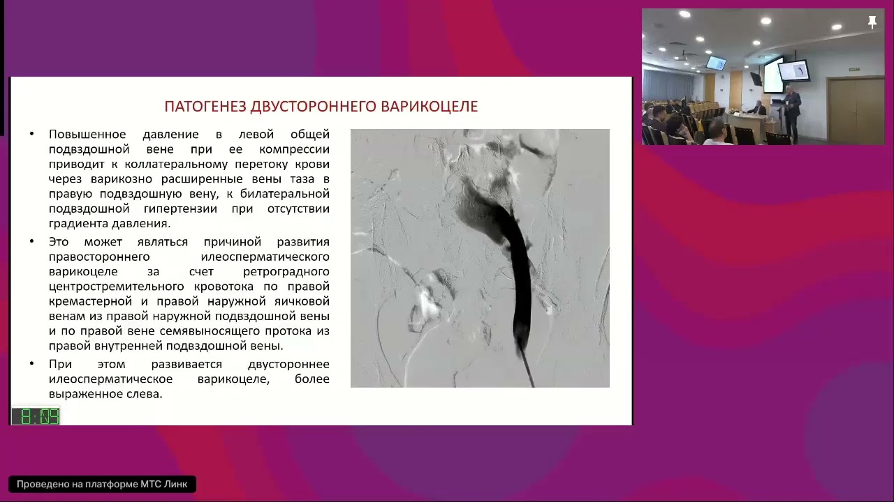 Капто А.А. Состояние сперматогенеза и гормонального статуса у пациентов с билатеральным варикоцеле.