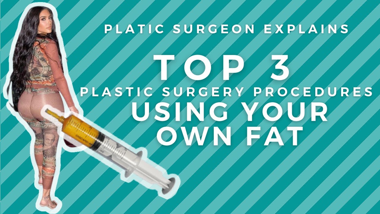 TOP 3 FAT TRANSFER SURGERIES: Kim K's butt, Facial Fat Grafting, and No Implant Breast Aug
