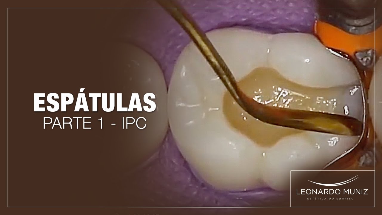 Espátulas: Parte 1 - IPC | Leonardo Muniz