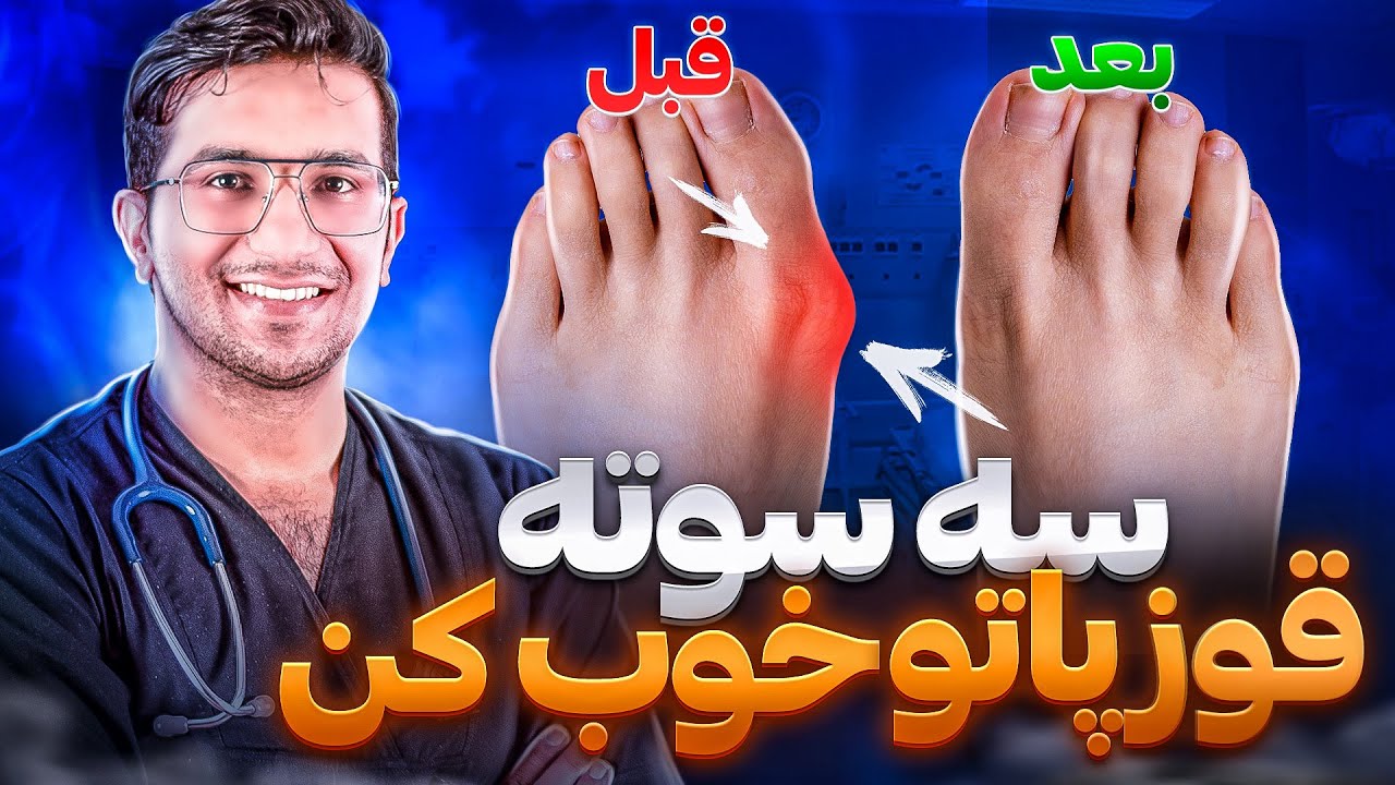 درمان قوز انگشت پا