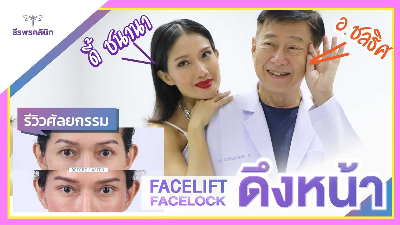 พี่ดี้ ชนานา x FACE-LOCK ในวัยเกือบ 60 ปี ที่ ธีรพรคลินิก หมอชลธิศ