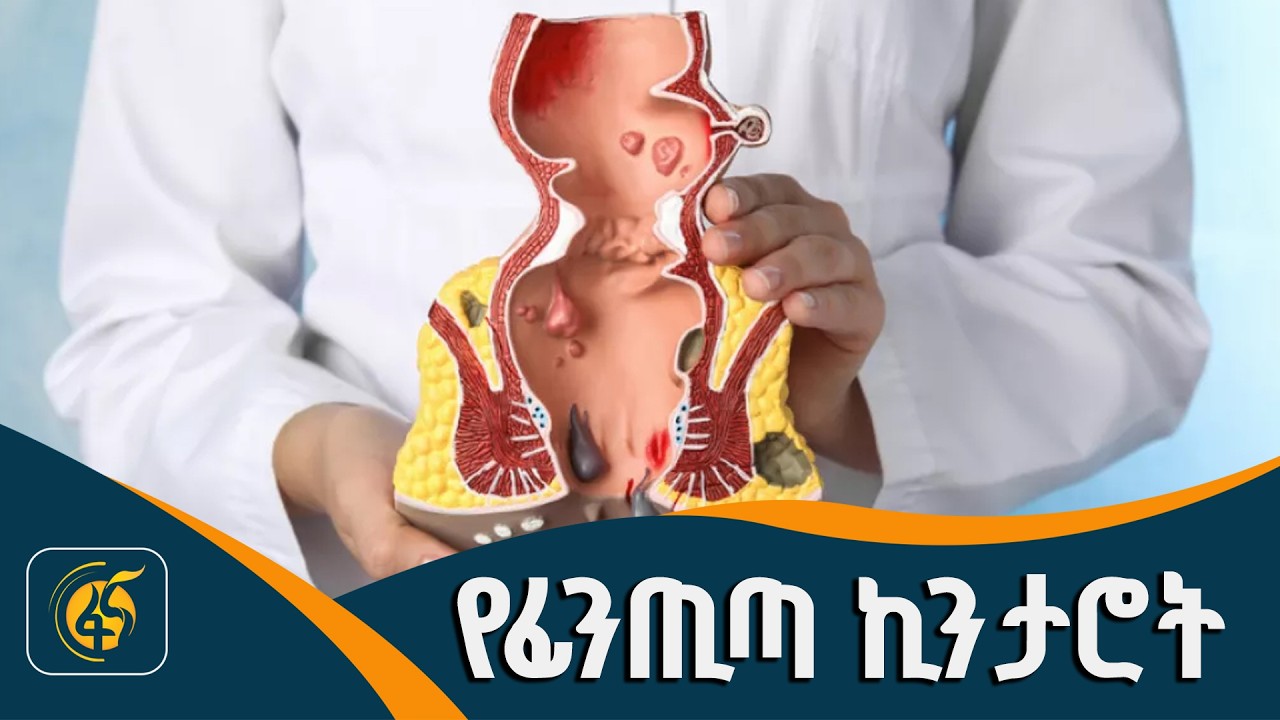 የፊንጢጣ ኪንታሮት ህመም መንስዔዎች