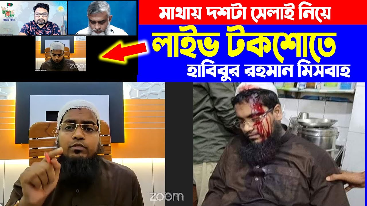 মাথায় দশটা সেলাই নিয়ে, লাইভ টকশোতে হাবিবুর রহমান মিসবাহ|habibur rohoman misbah