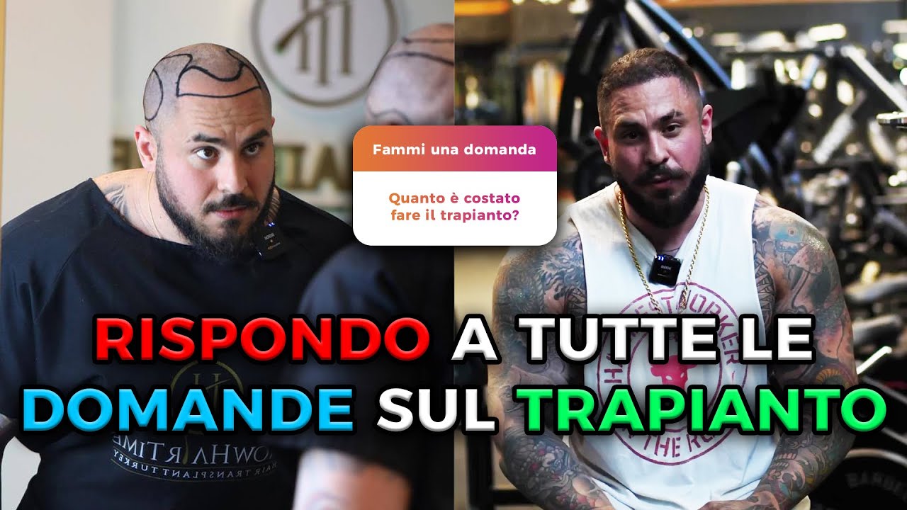 IL MIO TRAPIANTO DI CAPELLI |rispondo alle vostre domande