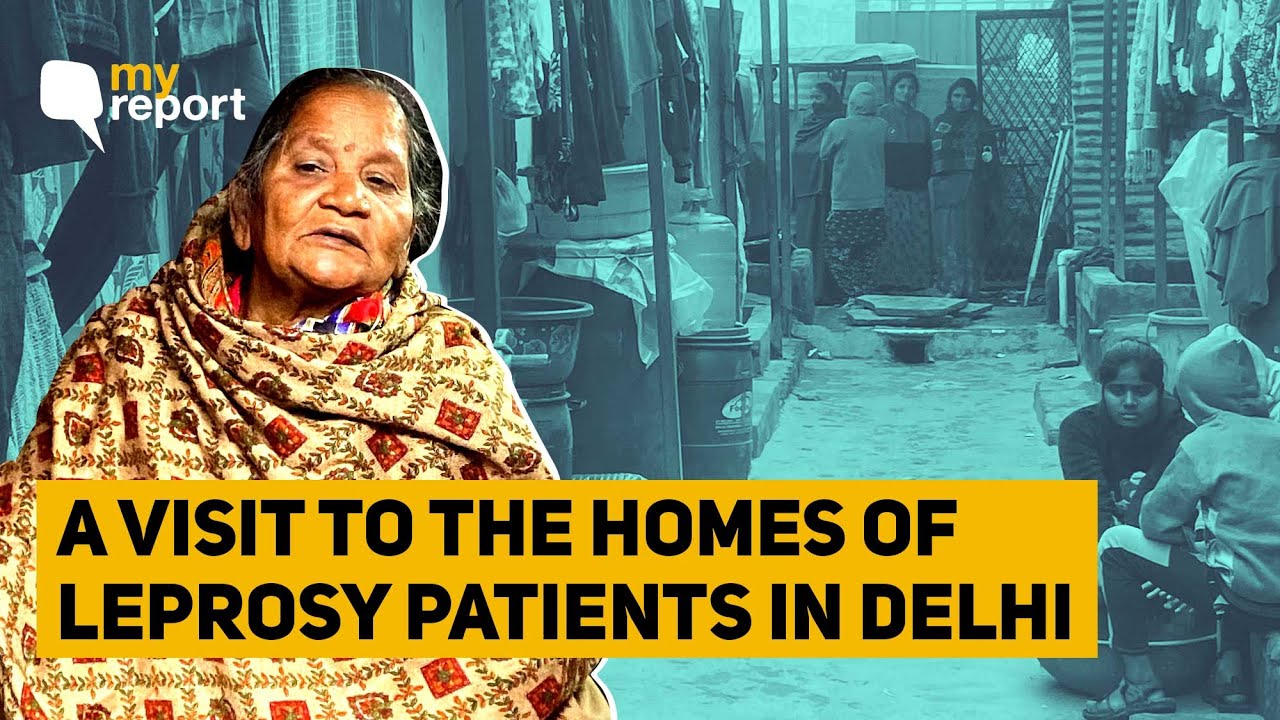 World Leprosy Day: 'Not Just Disease, We Have To Fight Stigma Too' | The Quint