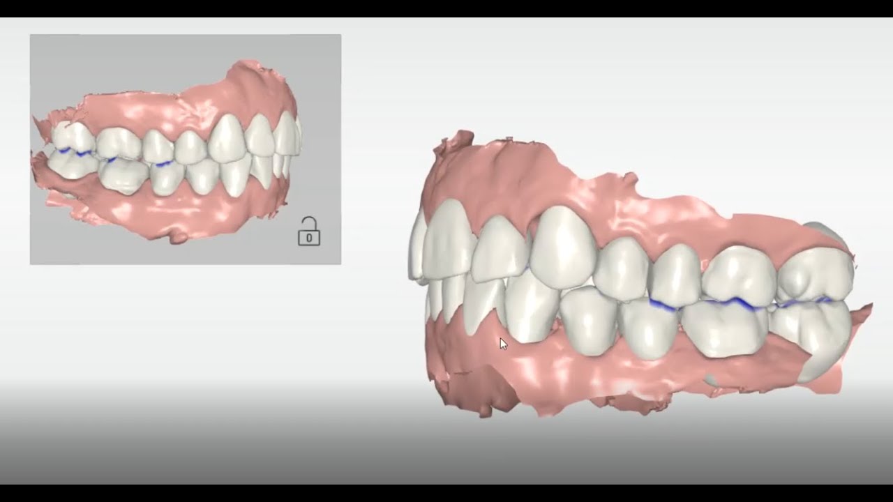 Cerec Ortho 2.0