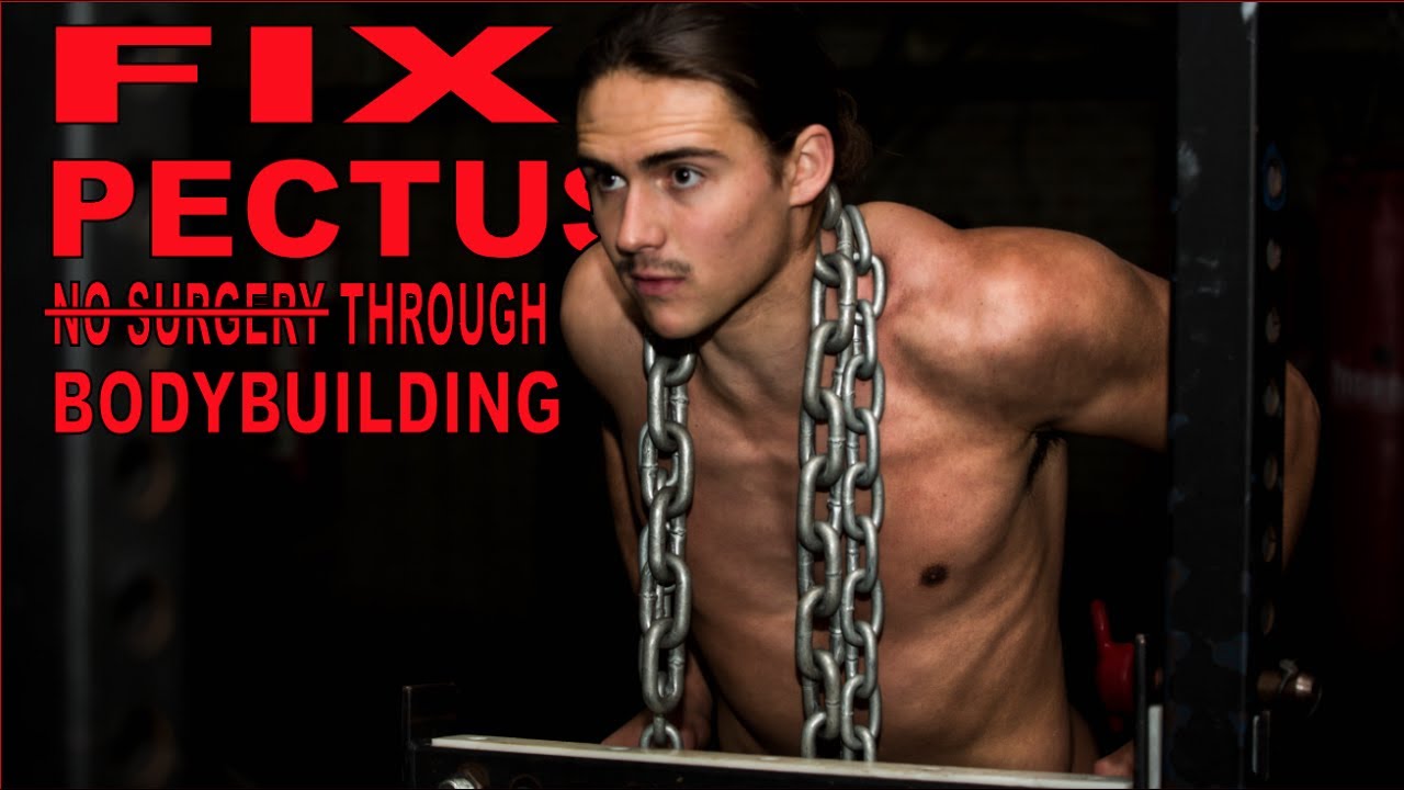 FIX PECTUS EXCAVATUM THROUGH BODYBUILDING
