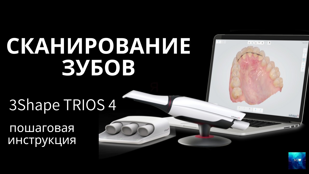 Полный протокол сканирования на 3Shape TRIOS 4 — зубы, мультиюниты, скан-трансферы