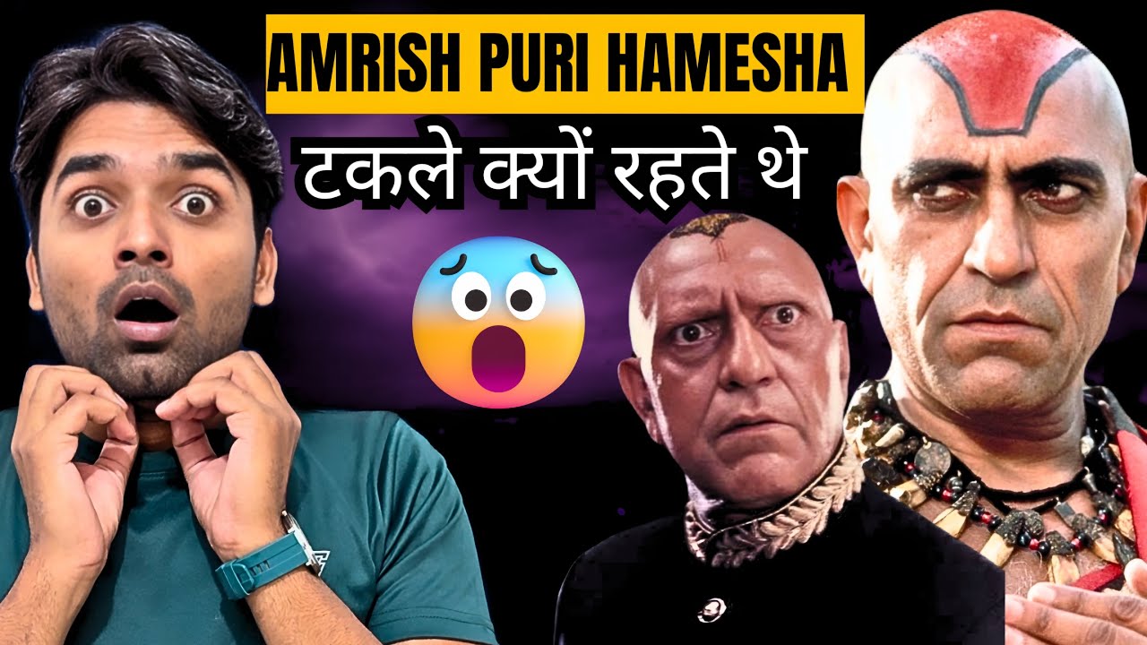 Why Amrish Puri was always bald￼