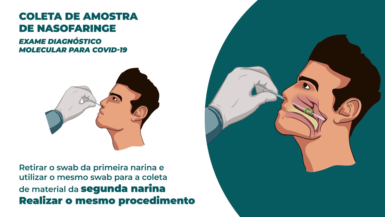 Instruções de coleta de testes RT-PCR para profissionais da saúde - Iniciativa COVID-19