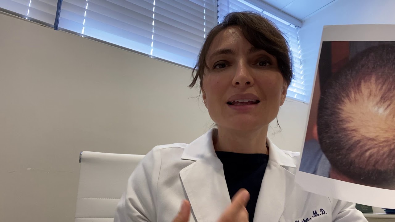 Da li je transplantacija kose trajna i zašto? - Dr. Gorana Kuka Epstein #transplantacijakose