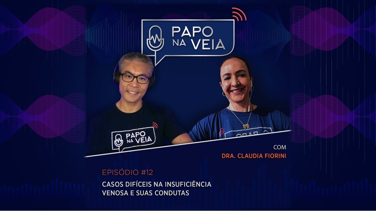 Podcast Papo na Veia EP12: Casos difíceis na insuficiência venosa e suas condutas
