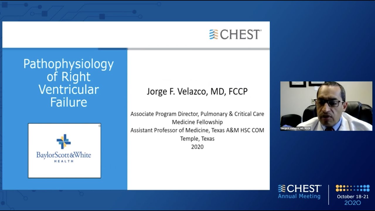 Acute Right Ventricular Failure: Is It the Worst Failure to Have?