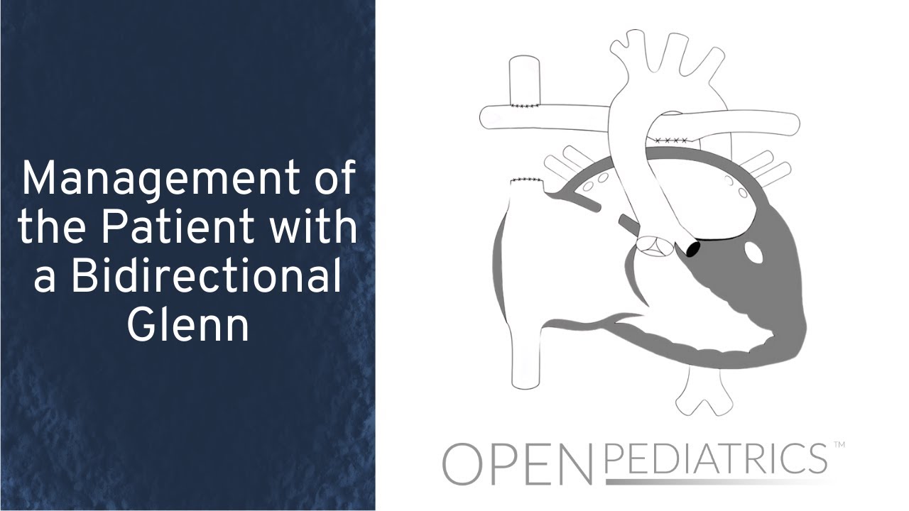 Management of the Patient with a Bidirectional Glenn by M. Jones | OPENPediatrics