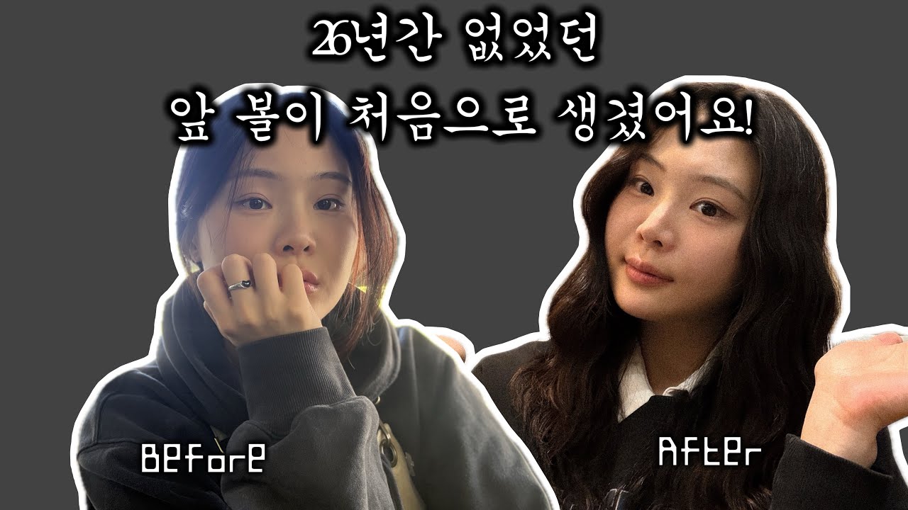 [일상VLOG] 올리지오 리프팅시술/올리지오 금액및병원/강남피부과/내돈내산 솔직리뷰