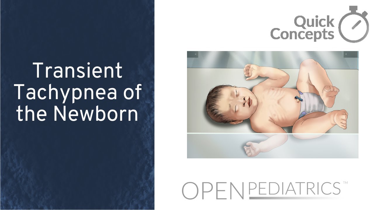 Transient Tachypnea of the Newborn by M. Connelly, et al. | OPENPediatrics