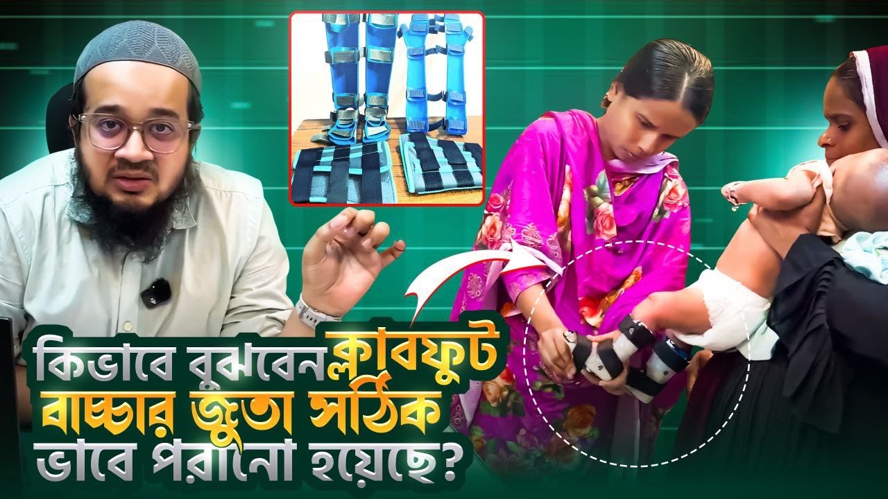 কিভাবে বুঝবেন ক্লাবফুট বাচ্চার জুতা সঠিক ভাবে পরানো হয়েছে? #club_foot #driftekhar