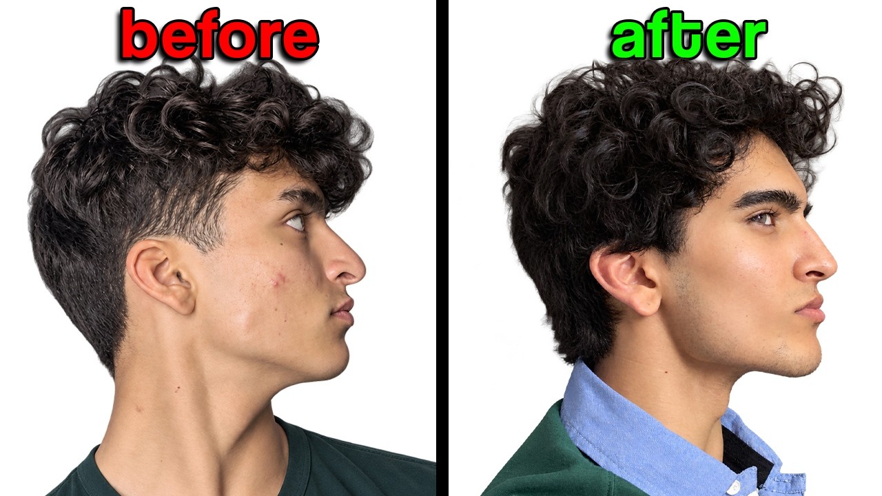 How I fixed my recessed face using physics (& how you can too...)