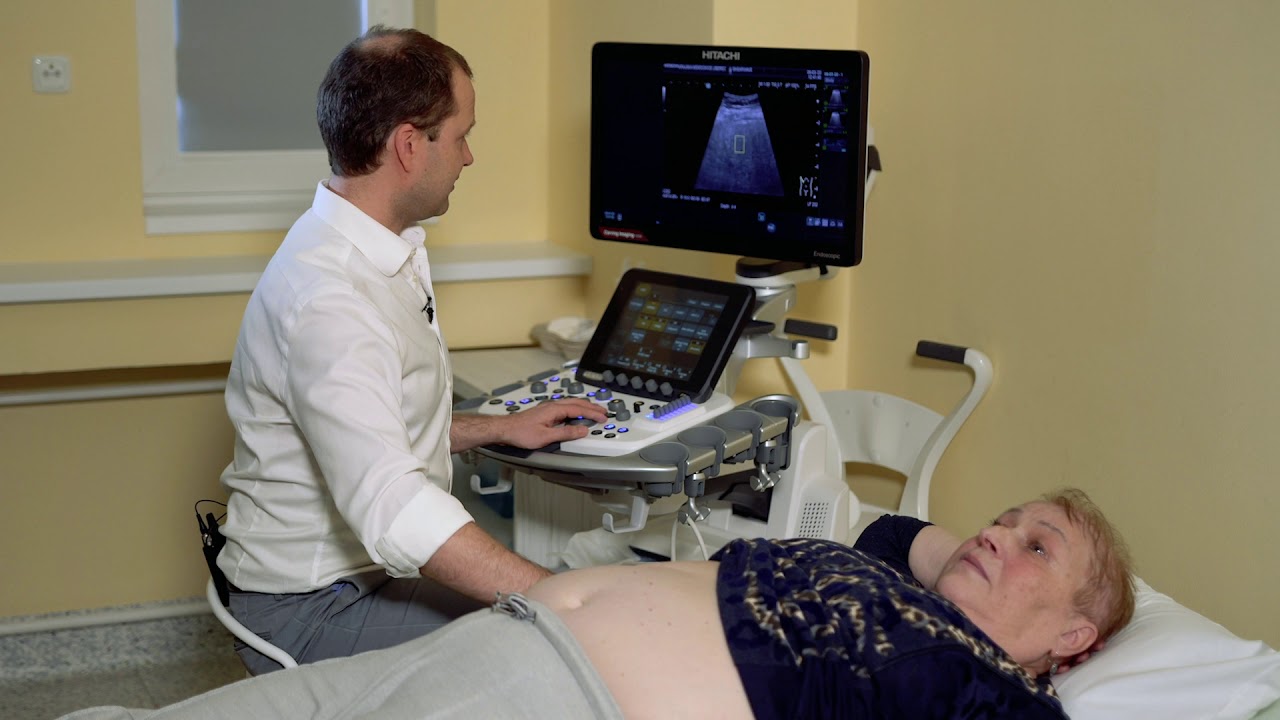 Ultrasonografická elastografie jater