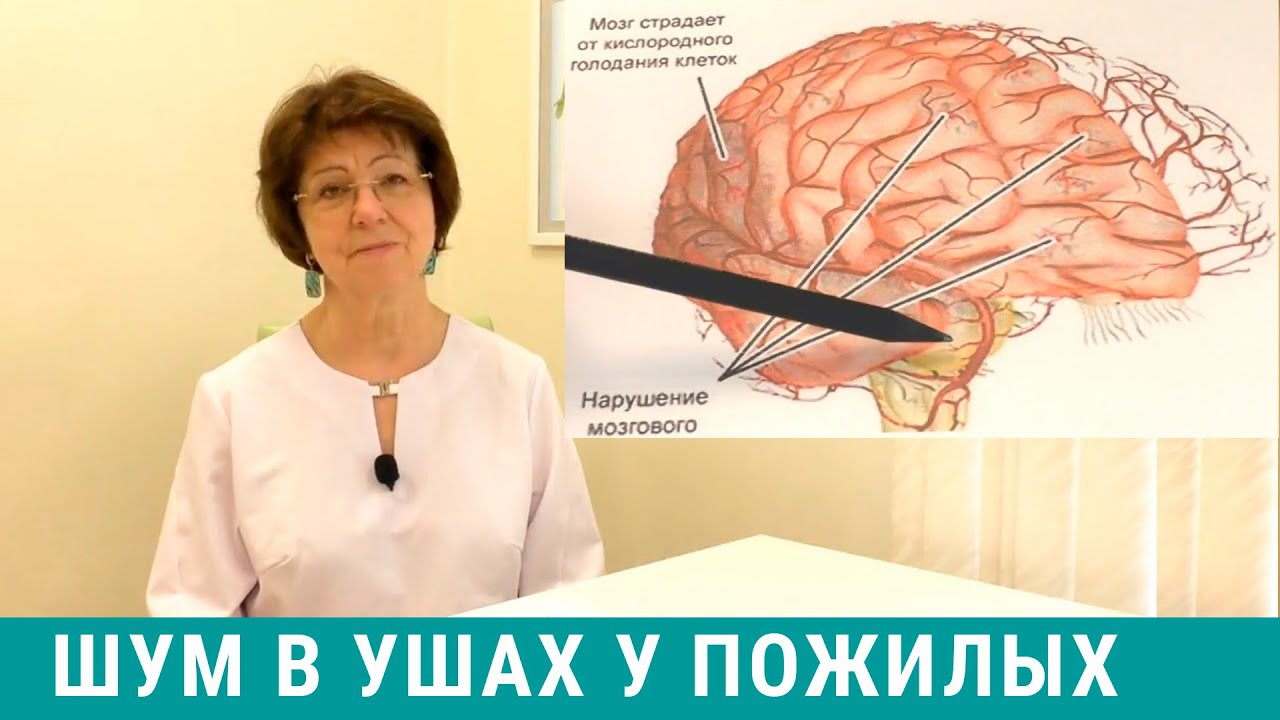 Шум в голове у пожилых: причины и лечение 