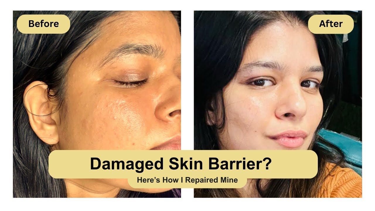 How I Heal My Damage Skin Barrier under Rs 250 (Unsponsored) + Sensitive Skin Barrier Repair Routine