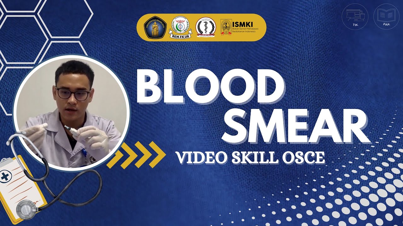[VIDEO SKILL OSCE - BLOOD SMEAR]