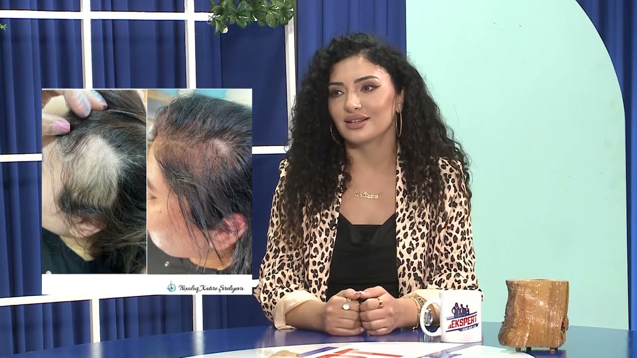 EKSPERT - Xatirə Şirəliyeva Həkim trixoloq