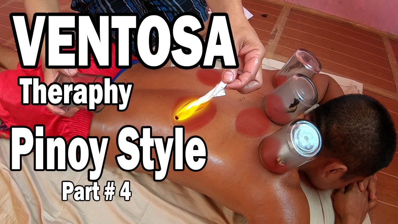 VENTOSA PINOY STYLE (Part 4) - TRADITIONAL MASSAGE