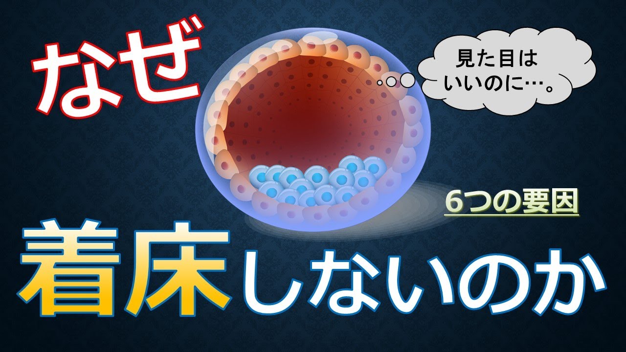 23 なぜ良好胚が着床しない？着床不全の全体像