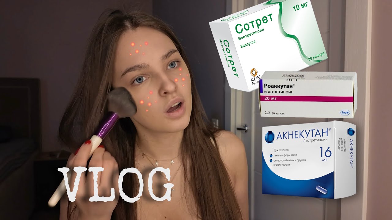 VLOG || РЕТИНОИДЫ, распаковка WB/OZON на 10тыс₽, всё о моих соц. сетях, кризис 20 лет и др.