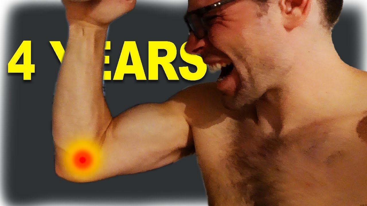 my climber's elbow experience